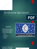 Sindrome de Torch