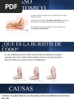 Bursitis de Codo