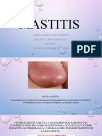 Mastitis