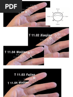 Puntos Acupuntura en - Carne y Hueso