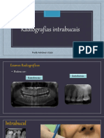 Radiografias Intrabucais