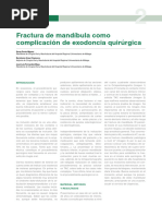 Fractura de Mandibula