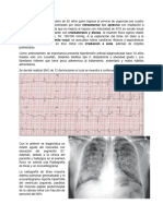 Caso Clínico de Intregración Hemodinámica y Electrica 2