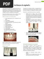 Instalação de Implantes