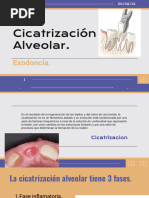 Cicatrizacion Alveolar