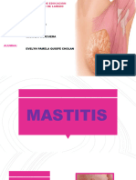 MASTITIS