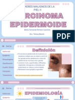 Carcinoma Epidermoide - Marifer Romero