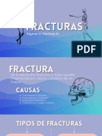 Fracturas