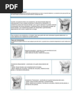 Colostomía e Ileostomia