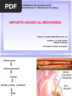 Infarto Agudo Al Miocardio1