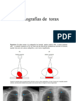 Radiografías Apoyo de Torax