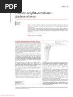 Fractures Des Plateaux Tibiaux