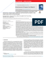 Idiopathic Giant Pancreatic Pseudocyst