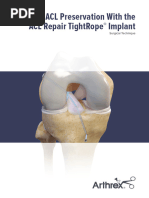 Acl Preservation With The Acl Repair Tightrope Implant