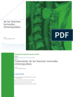 TOPICO I - Tratamiento de Las Lesiones Tumorales Intrarraquídeas