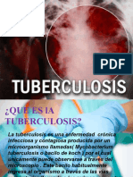 Tuberculosis