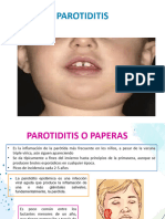 Parotiditis Pediatría