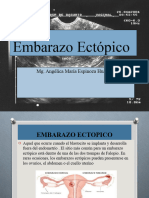 Embarazo Ectópico