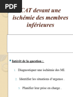 Ischémie Aigue Des Membres Inférieures