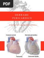 Derrame Pericardico y Taponamiento