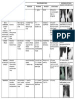 Tabla SD Respiratorios