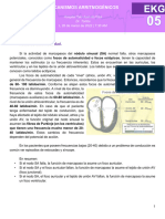 EKG05. Mecanismos Arritmogénicos. DR Tortós