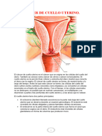 Cancer de Cuello Uterino