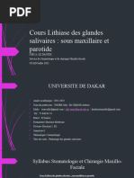 Lithiase Des Glandes Salivaire 2023