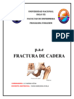 Pae Fractura de Cadera