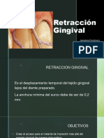 Retracción Gingival