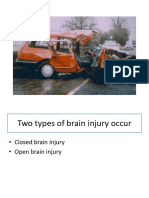 Trauma and Brain Injury