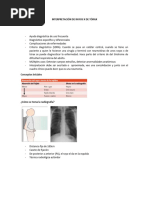 Interpretación de Rayos X de Tórax