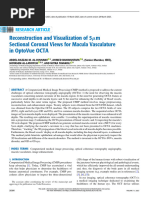 Reconstruction and Visualization of 5m Sectional Coronal Views For Macula Vasculature in OptoVue OCTA