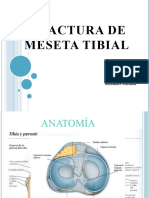 Fractura de Meseta Tibial 1