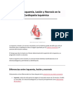 Cardiopatía Isquémica