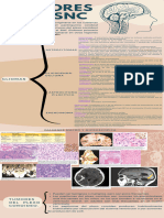 Tumores Del SNC Infografia