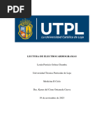 Lectura de Electrocardiogramas: Lenin Patricio Ochoa Chamba