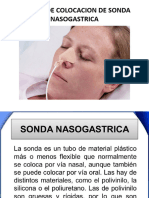 Sonda Nasogastrica