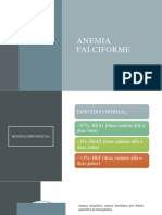 Anemia Falciforme