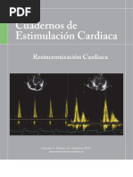 CEC 12 Resincronizacion Cardiaca