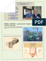 Bypass Gastrico Con Tecnica Del Doppio Loop