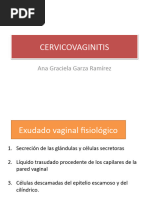 Cervicovaginitis - Gine