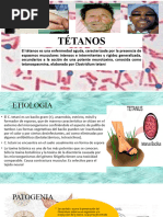 TÉTANOS