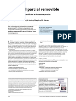 2 The Removable Partial Denture Equation - En.es