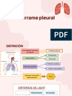 Derrame Pleural