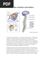 2 - Lesão Medular Traumática