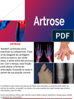 Artrose