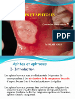 Aphtes Et Aphtoses 2