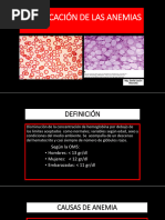 Clasificacion de Las Anemias