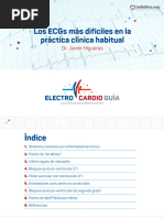 Los Ecgs Mas Dificiles en La Practica Clinica Habitual